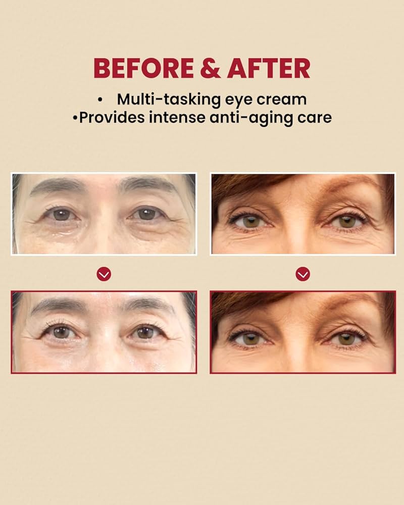 KSECRET Seoul 1988 , liposome rétinien 4 %, haricot fermenté