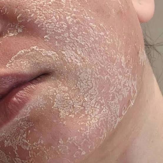 Peeling aux algues Zena