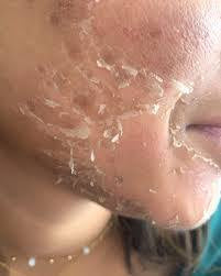 Peeling aux algues Zena